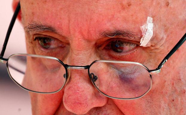 El papa Francisco, tras el incidente.
